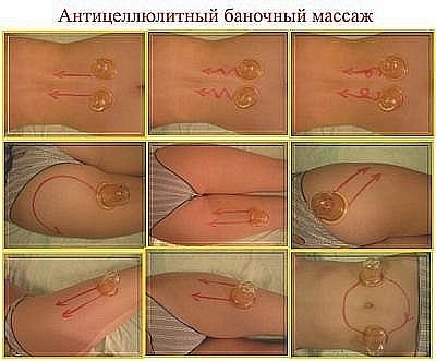 Анти целлюлитный массаж.jpg